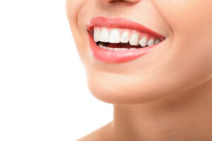 Woman with a bright, healthy smile showcasing veneers and teeth whitening results