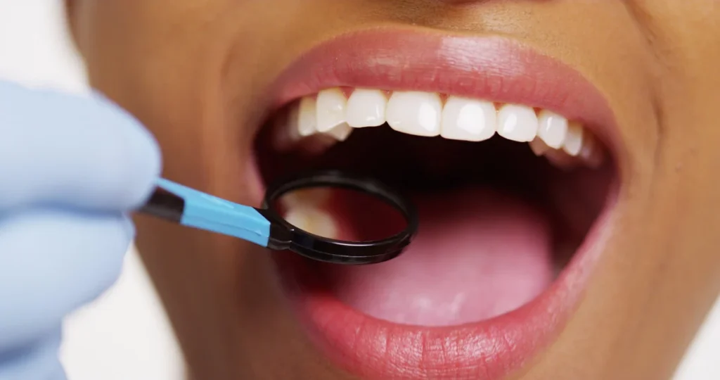 Close up of smiling black woman at dentist